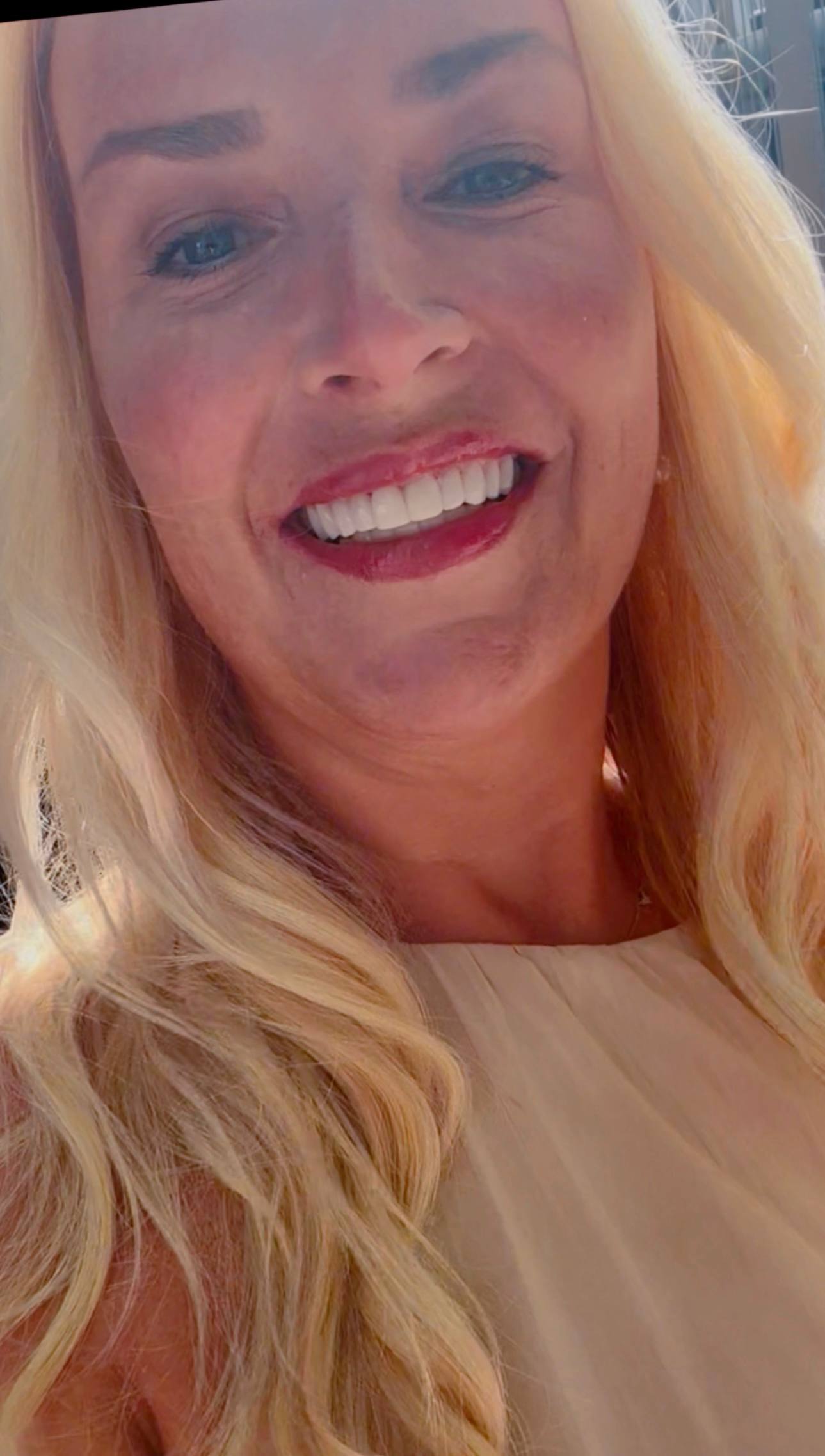 Patient smile after treatment