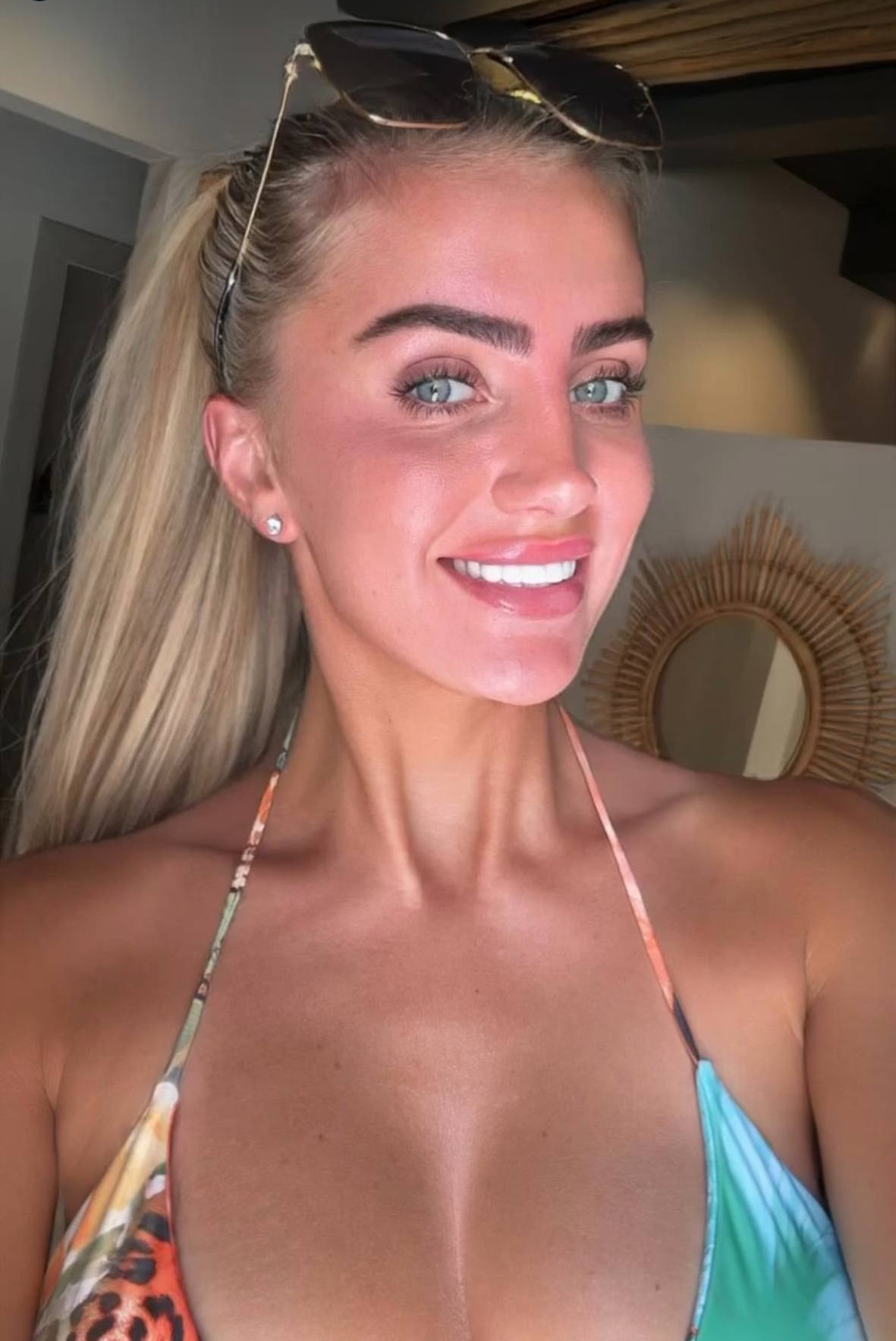 Patient smile after treatment