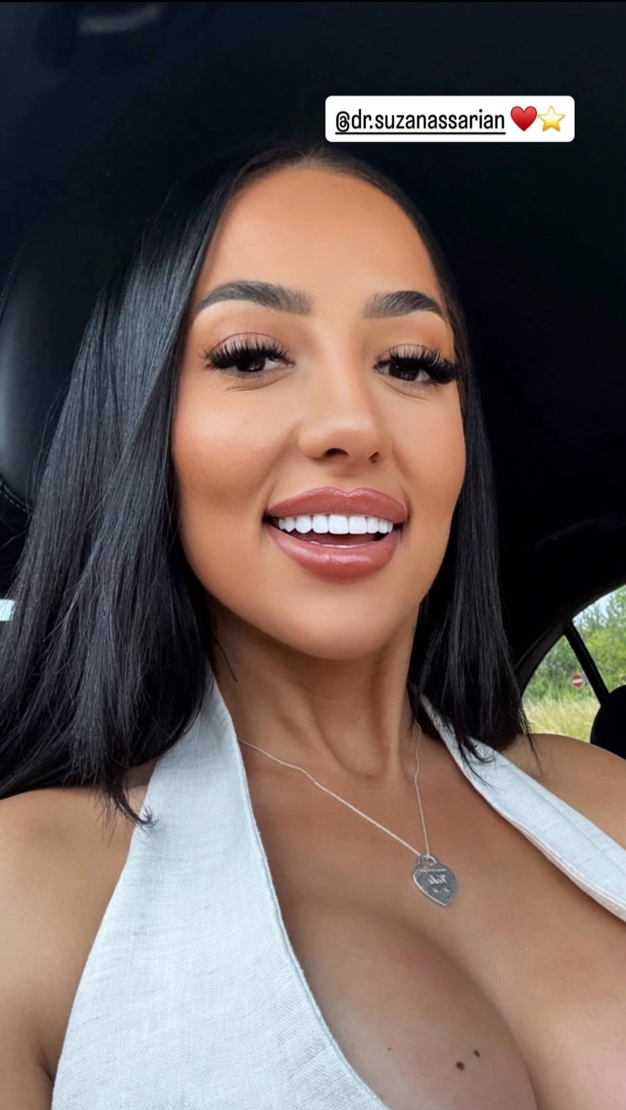 Patient smile after treatment