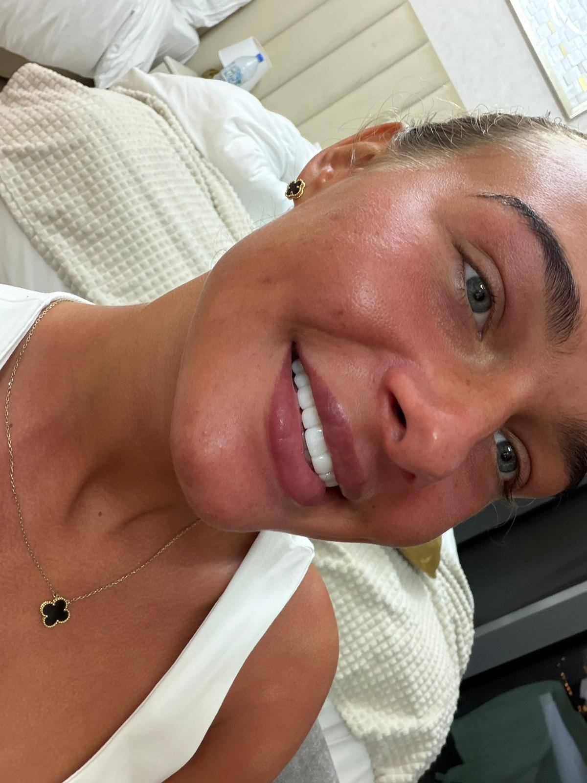 Patient smile after treatment